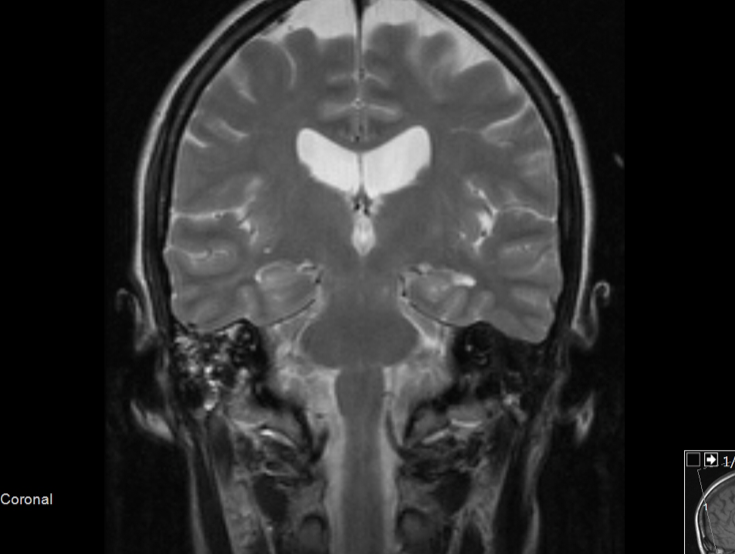 An x-ray showing images of the brain