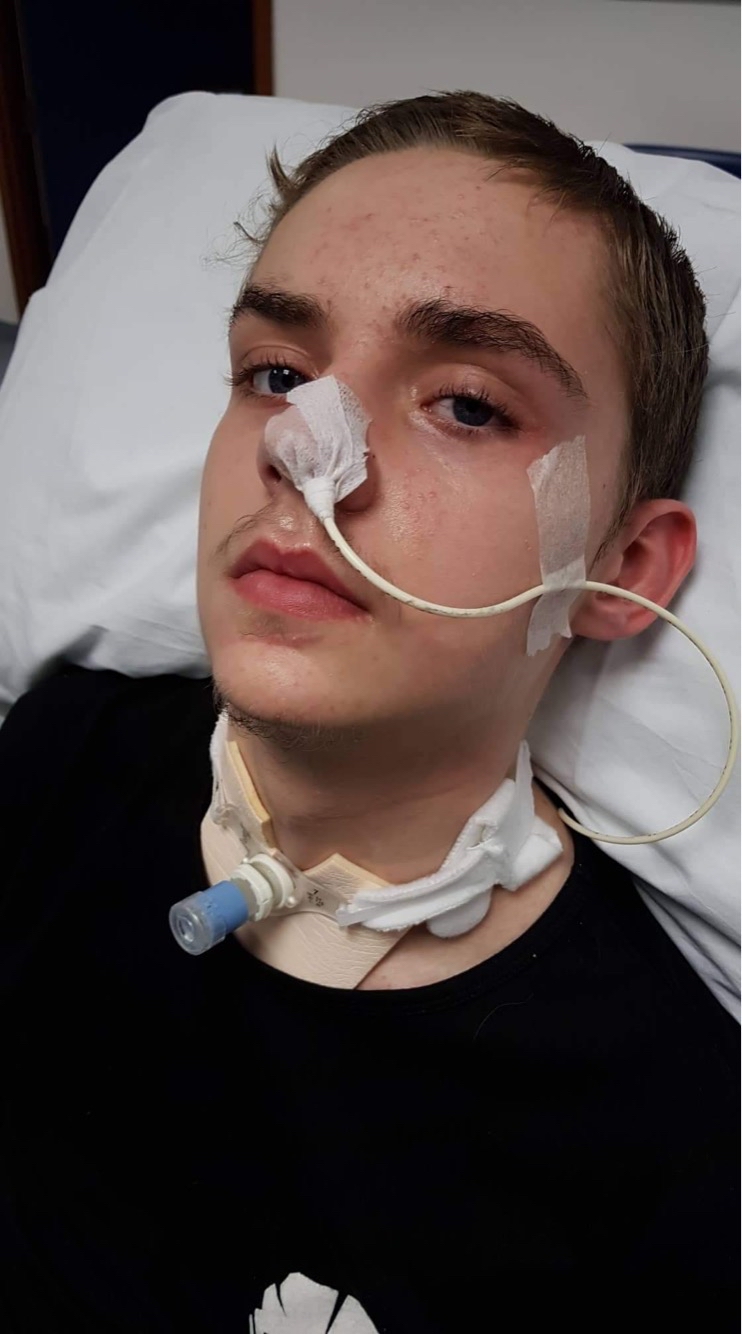 A man in hospital with tubes in his throat and nose
