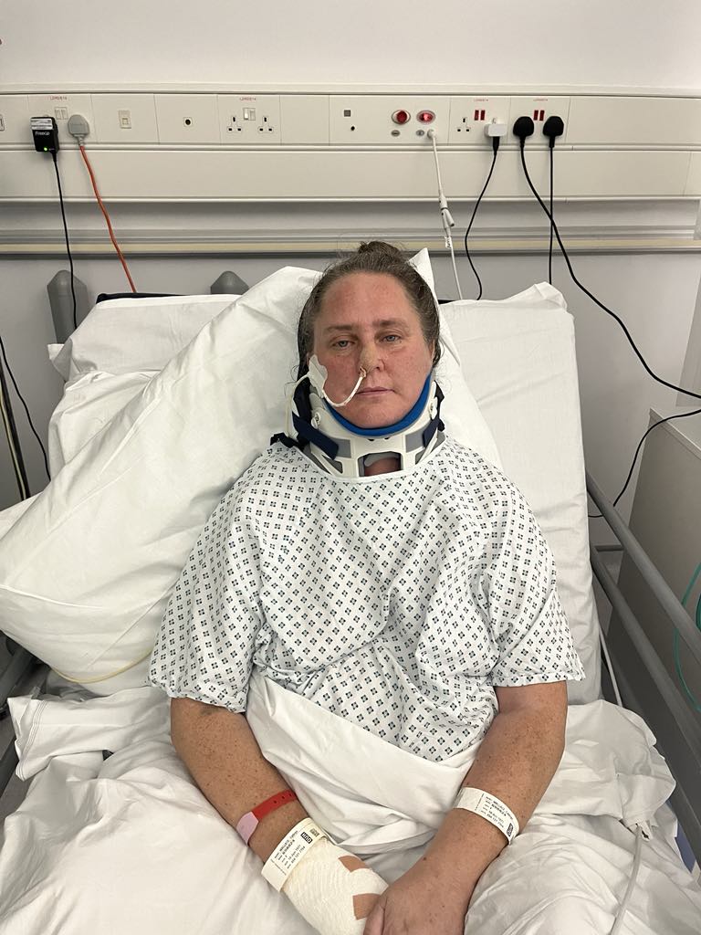 A lady in a hospital bed. She is wearing a neck collar and has a tube going into her nose and bandages on her right hand.